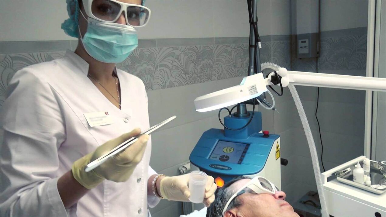 Preparation for a laser procedure to remove papillomas